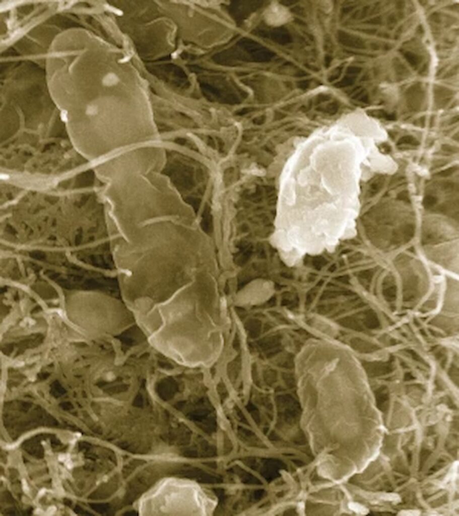Cientistas descobrem bactérias que transmutam materiais tóxicos em ouro
